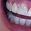 opalescence teeth whitening instructions